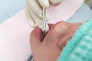 新潟市で肛門の悩みを相談するなら